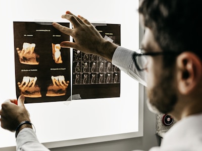 十岁的蛀牙，三十年的代价：一位中年男士的种植牙之路